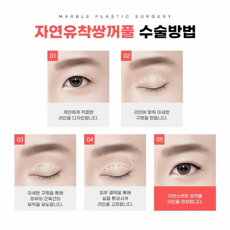 눈성형으로 얼굴비율 맞추기! 디자인의 중요성 관련 이미지 3