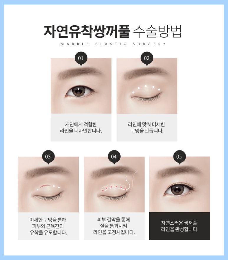 자연유착후기 자연스러워서 맘에 들어요! 관련 이미지 9