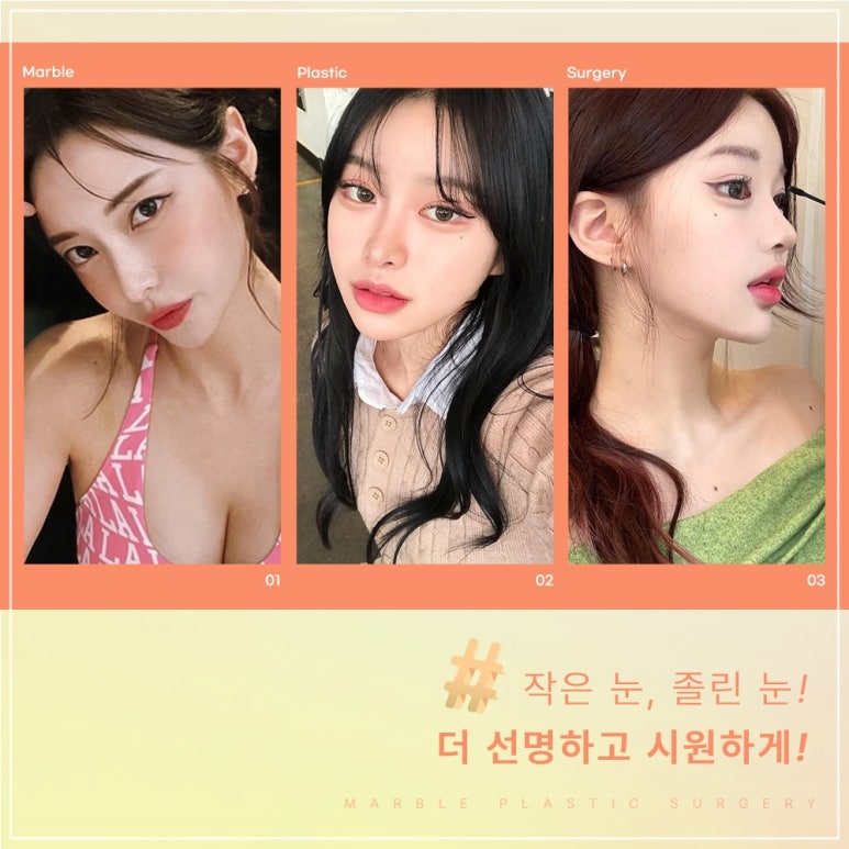 강남역 고등학생눈매교정잘하는곳, 시술방법, 장점, 필요성 관련 이미지 9