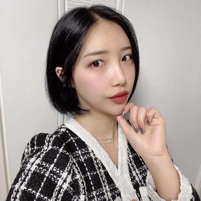 얼굴지방이식 황금비율까지 고려하여! 마블성형외과의원 관련 이미지 4