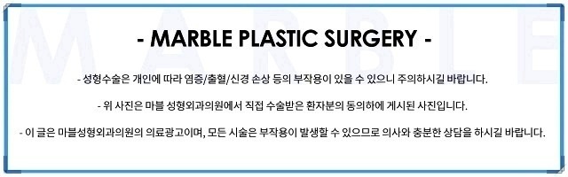 눈성형외과유명한곳, 눈 병원을 찾는다면 관련 이미지 14