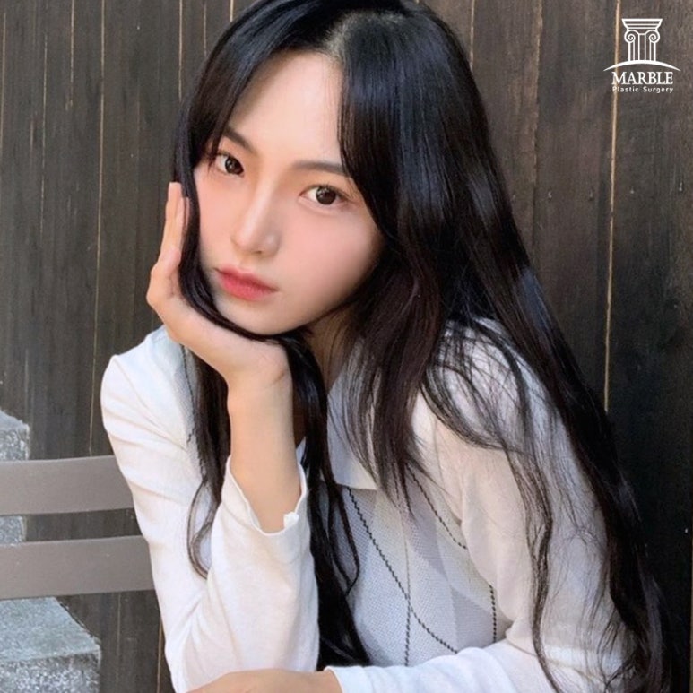 쌍꺼풀풀림 원인과 해결 방법은? 관련 이미지 5