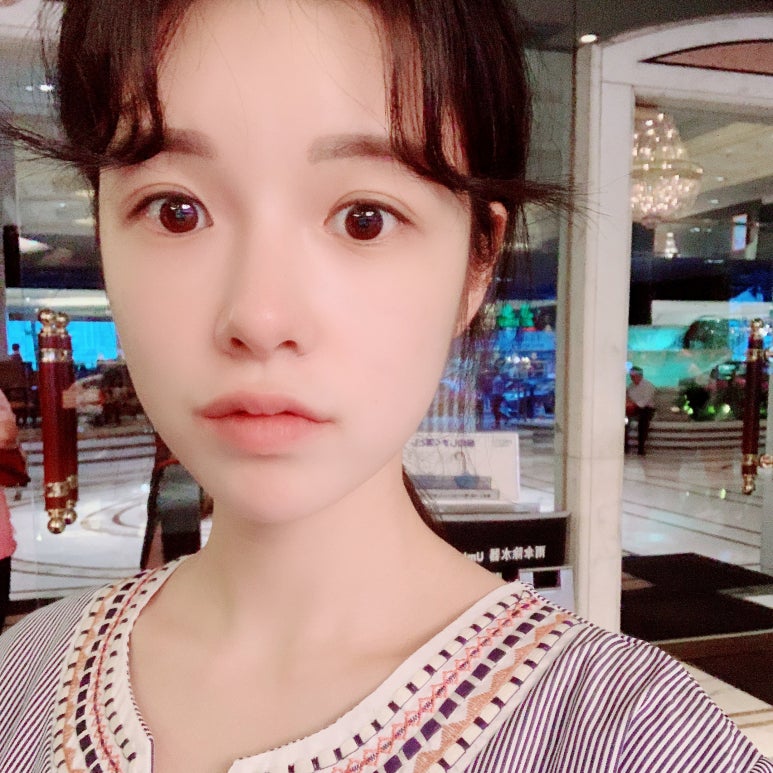 절개눈매교정 올바르게 결정하자! 관련 이미지 5