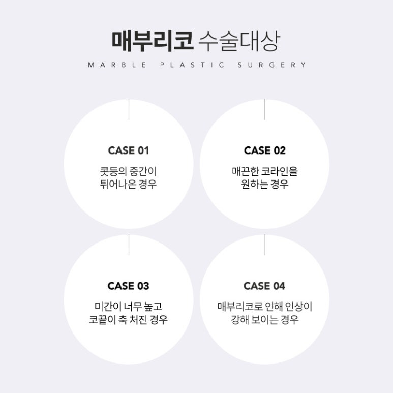 매부리코 성형, 매끄러운 코 라인 마블성형외과의원 관련 이미지 4