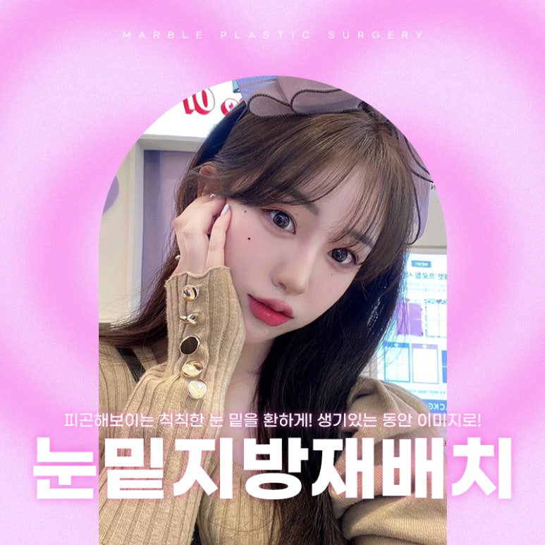 눈밑지방재배치수술후 성공적인 변화 마블성형외과 관련 이미지 1