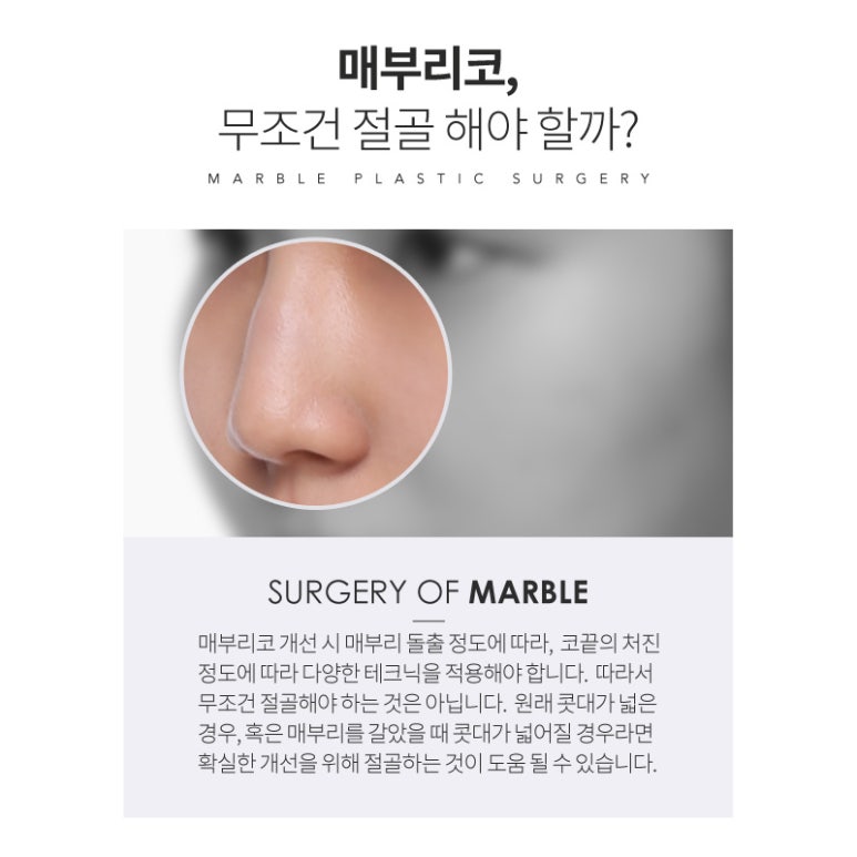 매부리코성형비용 후기까지 살펴보고 관련 이미지 4