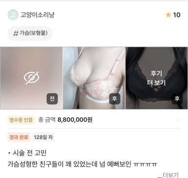 [강남역성형외과 가슴수술 후기] 성형 후 티날까봐 걱정했었는데.. 진짜 내 가슴 같이 자연스러워요 관련 이미지 1