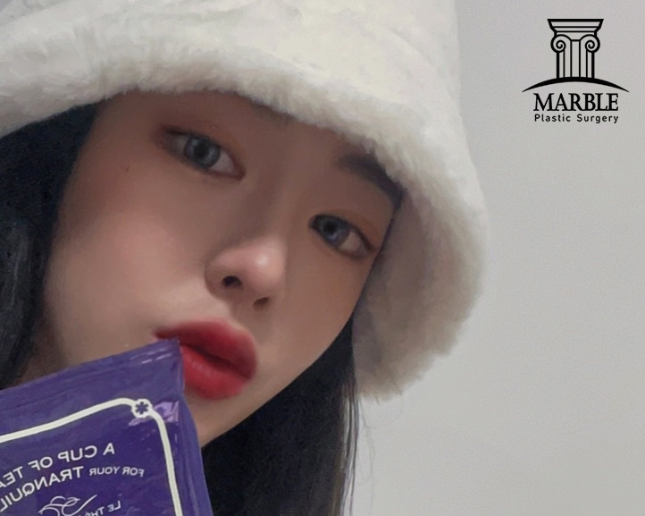 듀얼트임, 자연스럽게 예뻐지는 방법! 마블성형외과의원 관련 이미지 3