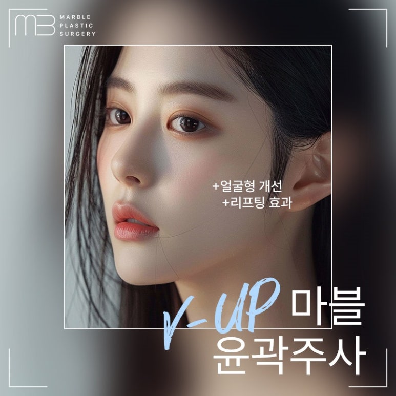 V업주사 마블성형외과 윤곽주사 이벤트기간 공유! 관련 이미지 1