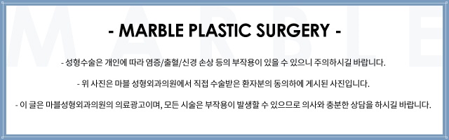 쌍꺼풀수술잘하는곳과 수험생을 위한 수험생이벤트 관련 이미지 15