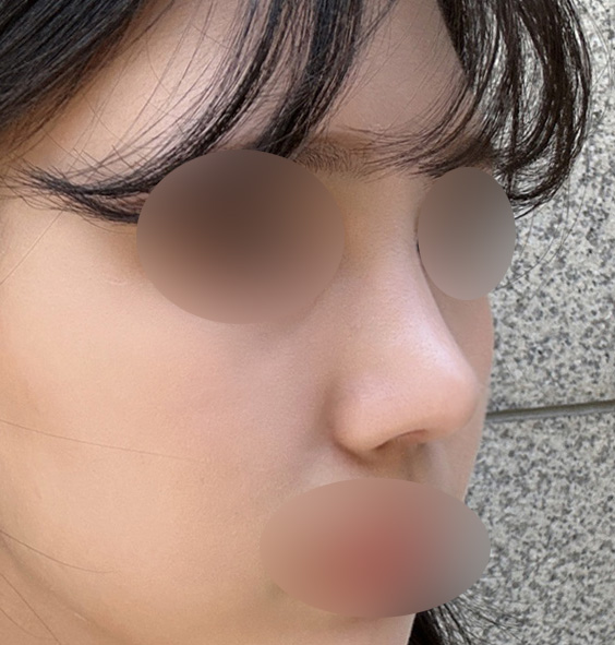 복코수술비용, 정확하게 찾아봐야 하는 이유 관련 이미지 6
