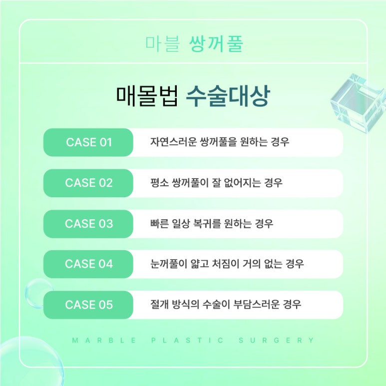 쌍수매몰 알고 싶은 모든 것 관련 이미지 4