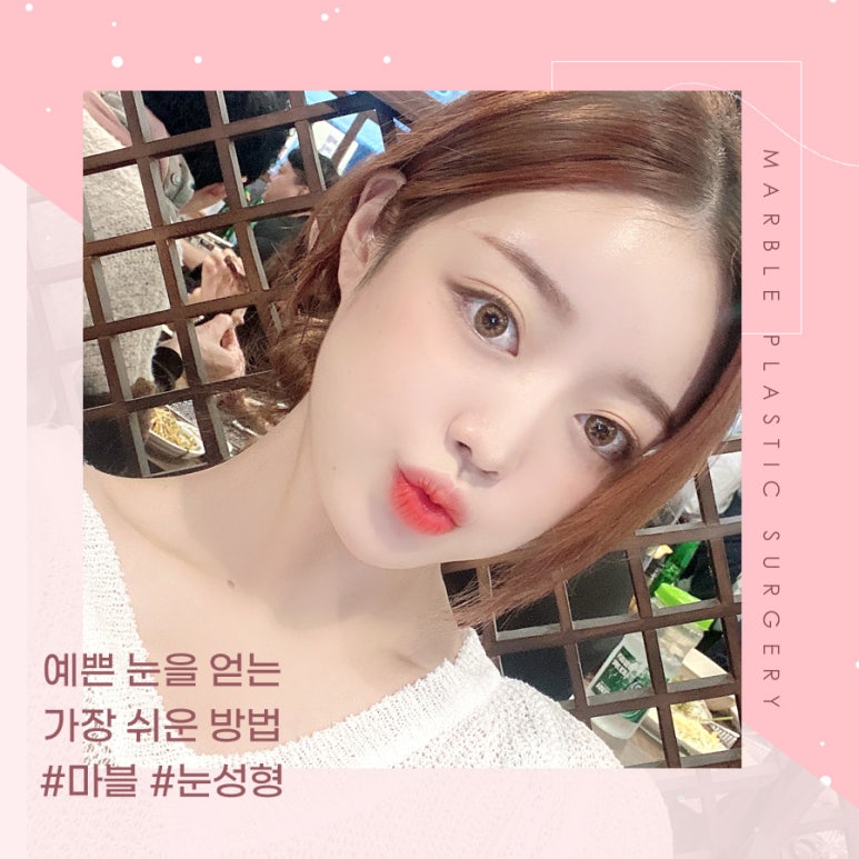 눈매교정잘하는곳 또렷한 눈매로 관련 이미지 9