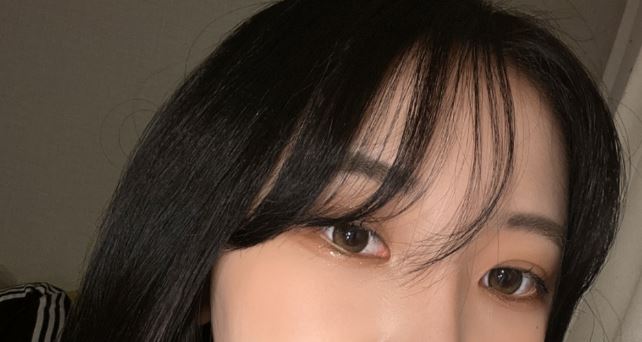 쌍꺼풀 수술후 관리할때 꼭 알아야할것들 관련 이미지 4