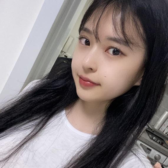 연예인 눈성형 쌍꺼풀라인 특징부터 관련 이미지 7