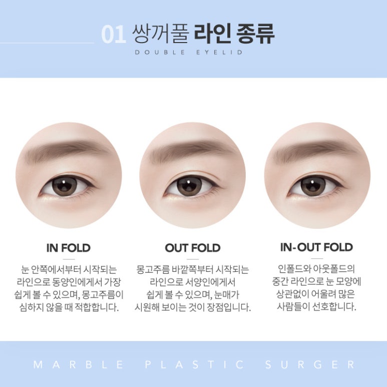 강남쌍꺼풀수술 체크해야 할 사항은? 관련 이미지 5
