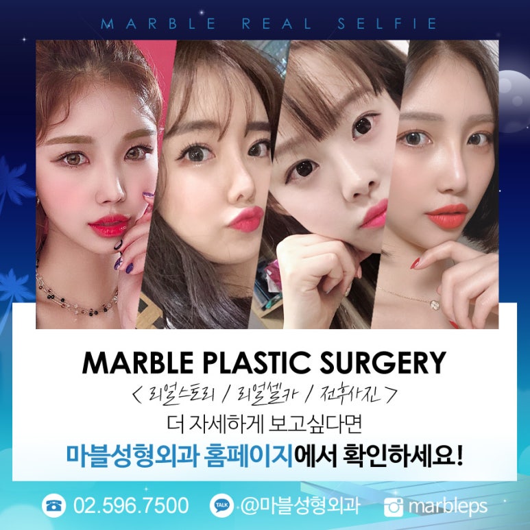 자연유착쌍꺼풀 흉터 풀림 고민 말고 내추럴함!마블성형외과의원 관련 이미지 8