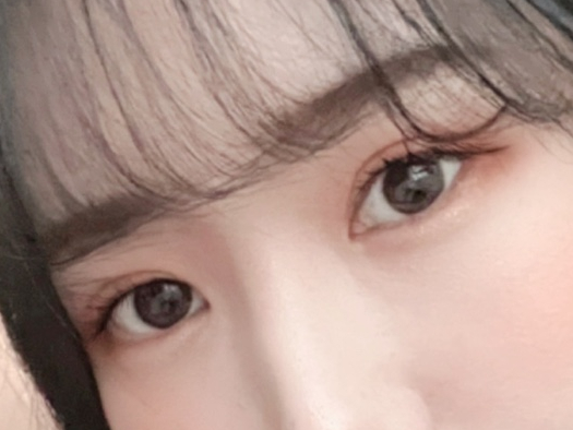눈매교정부작용 벗어날 방법 알아보기 관련 이미지 2
