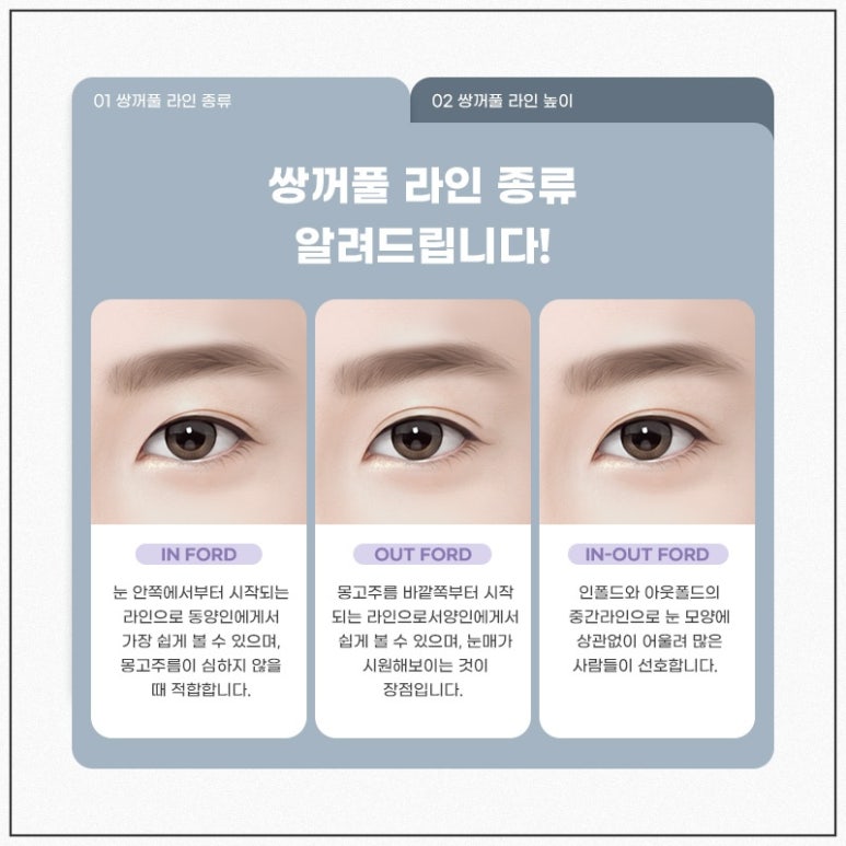 쌍꺼풀수술잘하는곳, 자연유착 잘하는 병원 관련 이미지 6
