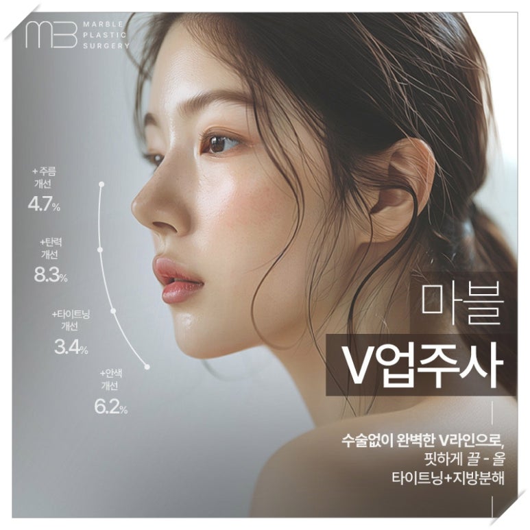 마블성형외과의 V업주사 (브이업주사), 왜 특별할까? (전후사진O) 관련 이미지 4