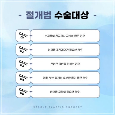 눈성형잘하는병원, 쌍꺼풀수술, 트임수술 관하여 관련 이미지 3