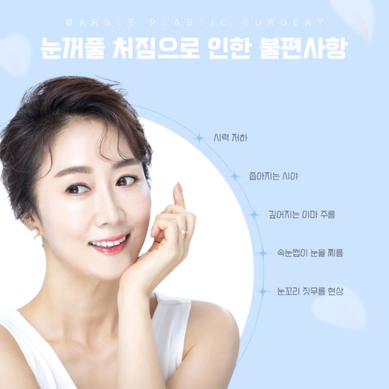 중년눈성형 더 예리하고 젊게 관련 이미지 10