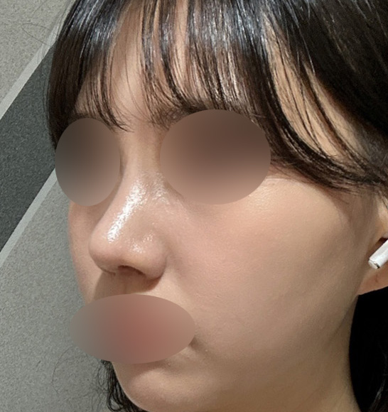 복코수술비용, 정확하게 찾아봐야 하는 이유 관련 이미지 4