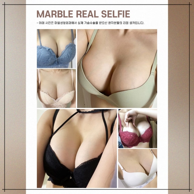 Why Is Mentor Breast Augmentation So Popular in Gangnam? Marble Plastic Surgery Clinic image 12