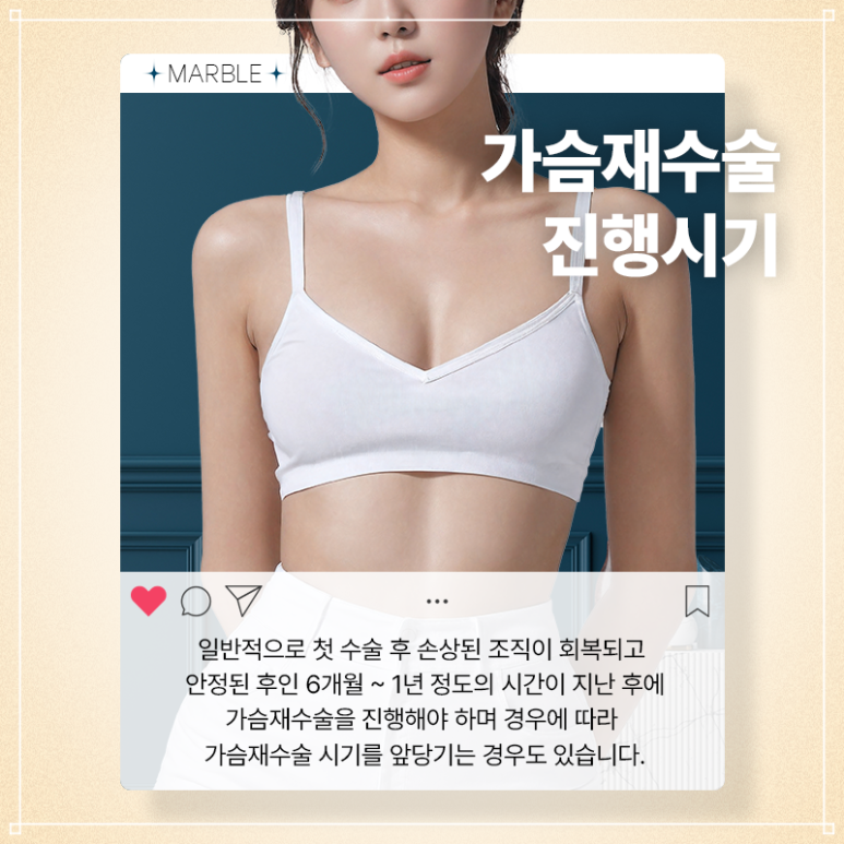 모티바가슴재수술 만족도 높은 강남성형외과 찾는다면｜마블성형외과의원 관련 이미지 11