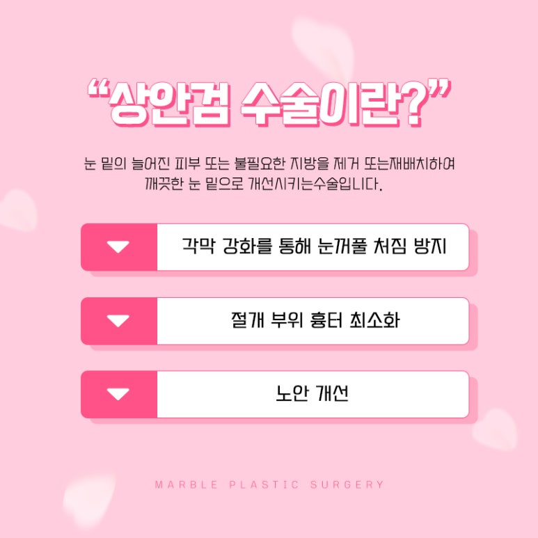 상안검수술비용 따지기 전에 확인하자 관련 이미지 2