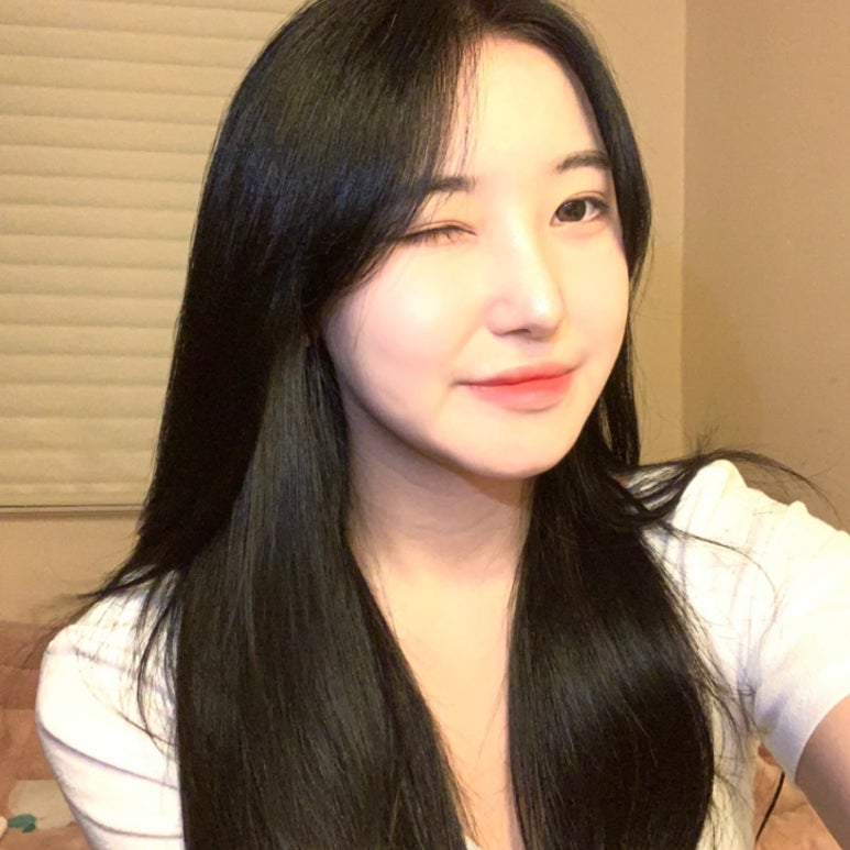 눈성형종류 생각보다 더 다양하다! 관련 이미지 6