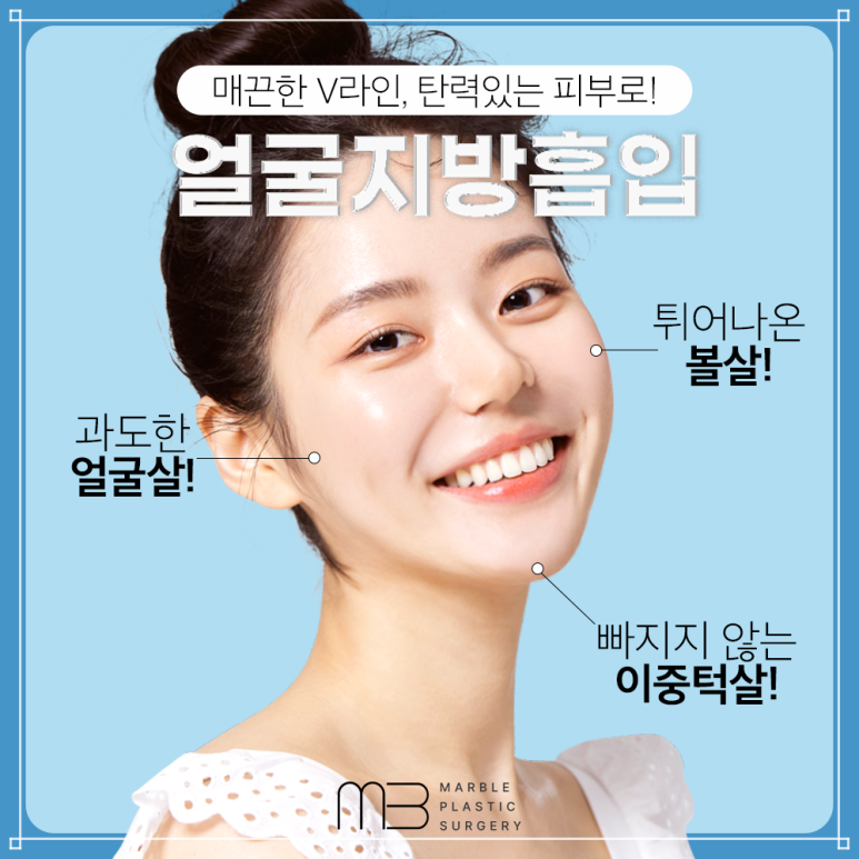 Worried About Swelling After Facial Liposuction? Here’s a Summary of Who It’s For and Recovery Tips! | Marble Plastic Surgery image 4