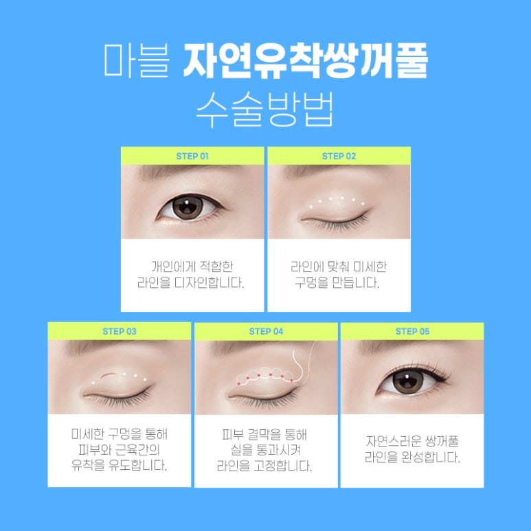 자연유착후기 기대와 현실적인 결과 관련 이미지 6