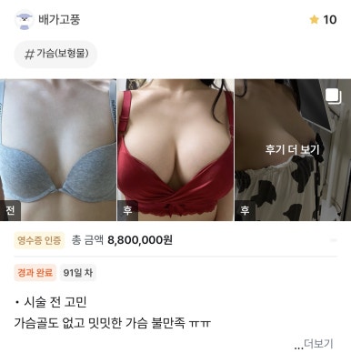 [Gangnam Station Plastic Surgery Review] My Flat, Cleavage-Free Breasts.. I Finally Found My Perfect Look with Mentor Xtra Haha image 1