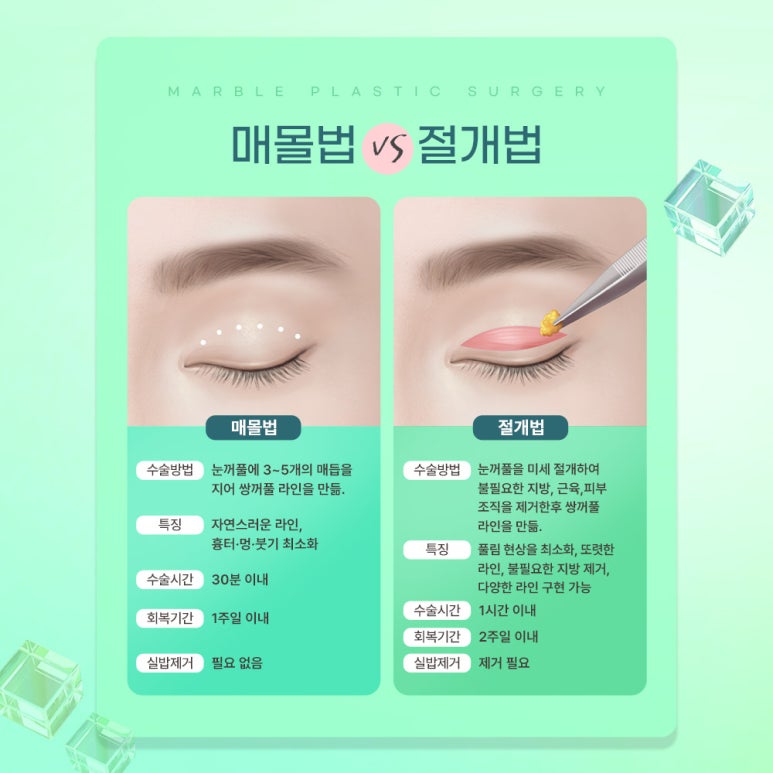 쌍수매몰 알고 싶은 모든 것 관련 이미지 6