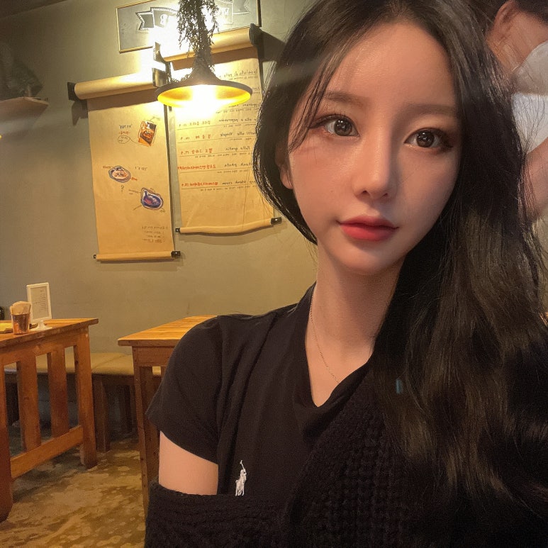 뒷트임밑트임후기 시원한 또렷함으로 관련 이미지 4