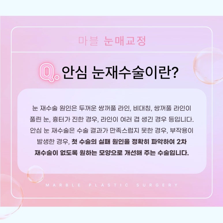 눈재수술 잘 알아봐야 관련 이미지 4