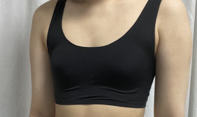 One-Month Real Review After Breast Augmentation ｜ From Right After Surgery to the Changes Over Time image 4
