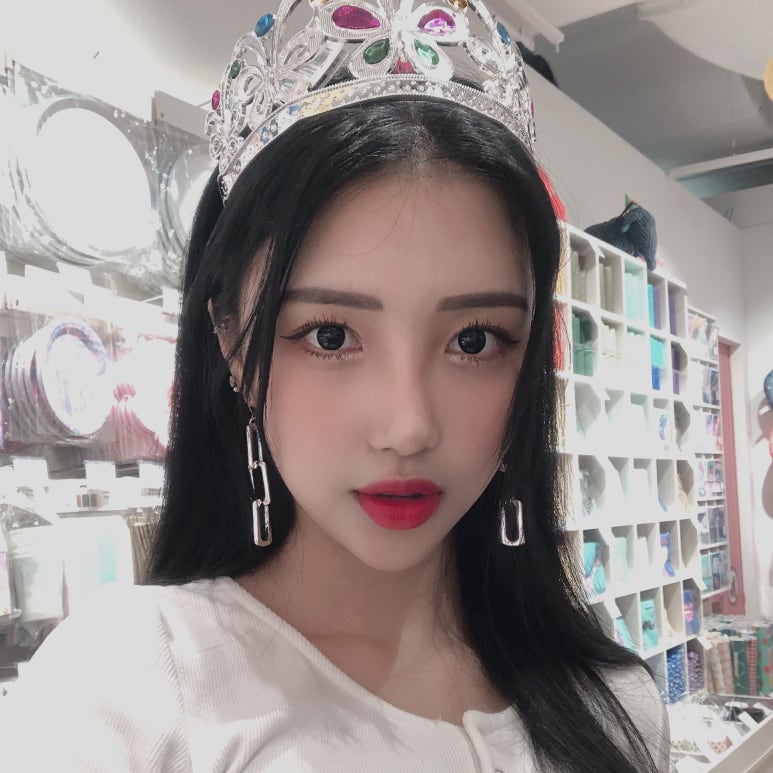 뒤트임가격 원하던 눈매로 변화 관련 이미지 5