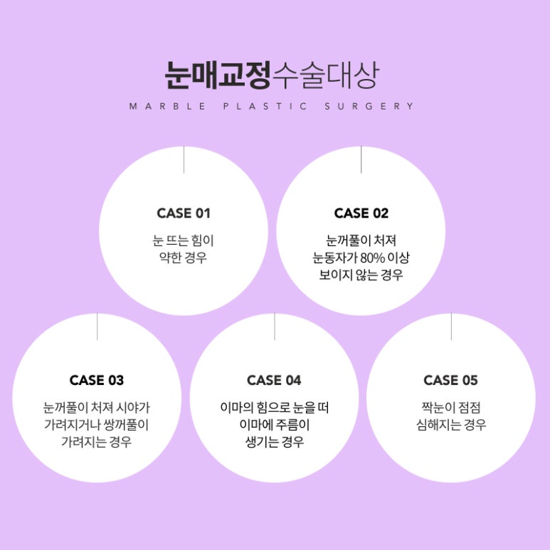 안검하수 처진눈 교정으로 또렷한 눈매를! 관련 이미지 9