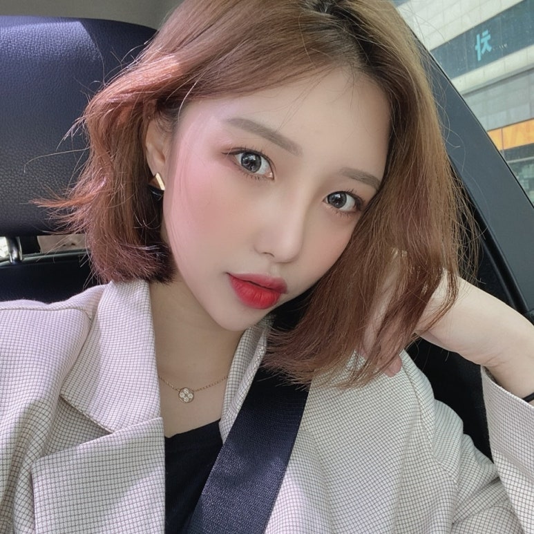 눈매교정술 중요한 포인트는? 관련 이미지 8