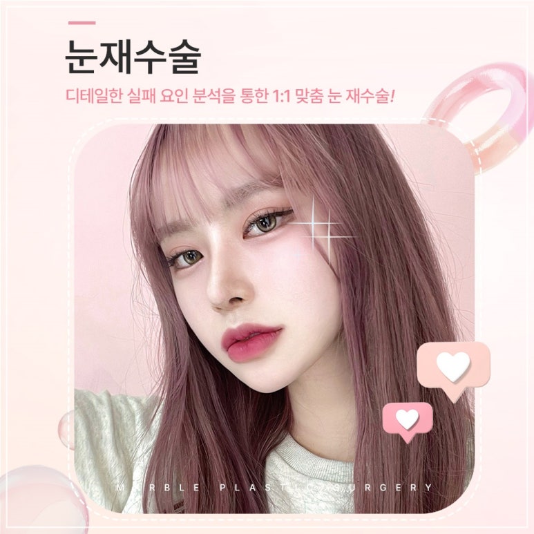 쌍수 눈재수술잘하는곳의 쌍꺼풀재수술 : 안전성, 심미적 측면, 비용 가격 등 관련 이미지 1