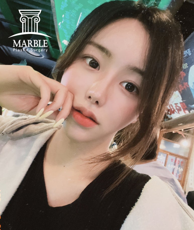 눈재수술 더 신중하게 고민해서 관련 이미지 6