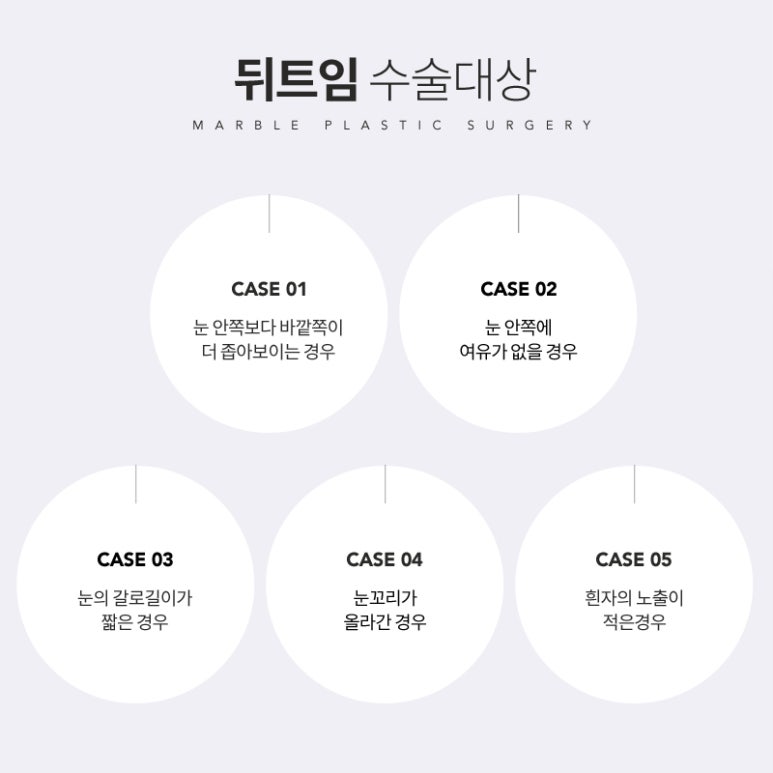 뒤트임 시원하고 또렷한 눈매로 관련 이미지 3