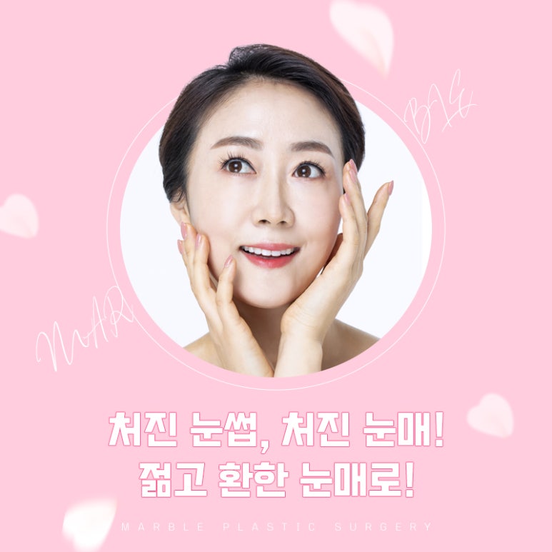 상안검수술비용 따지기 전에 확인하자 관련 이미지 7