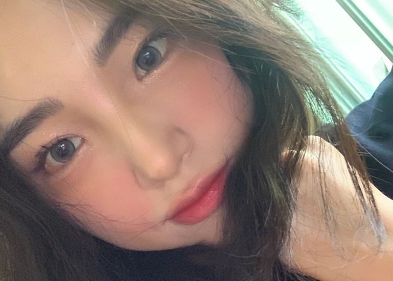 자연유착 쌍꺼풀 라인 따가움 어떻게 해야할까? 관련 이미지 2