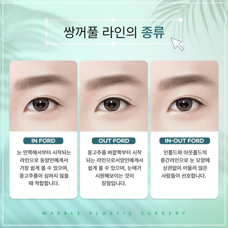 고등학생쌍수 마블이벤트에서 확인, 성형붓기빼는법은 덤으로 관련 이미지 8