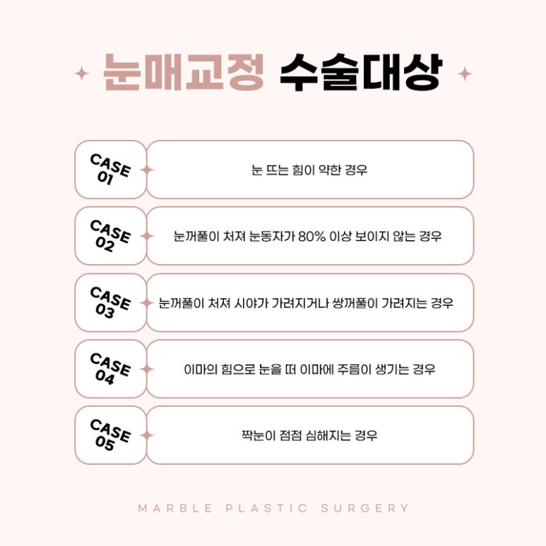 눈성형잘하는곳의 수술과 눈매교정에 대하여 관련 이미지 3