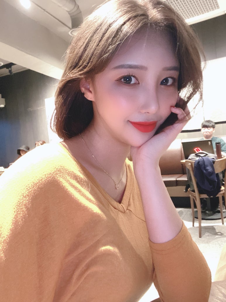 앞트임가격 시원한 눈매로 개선해 관련 이미지 6