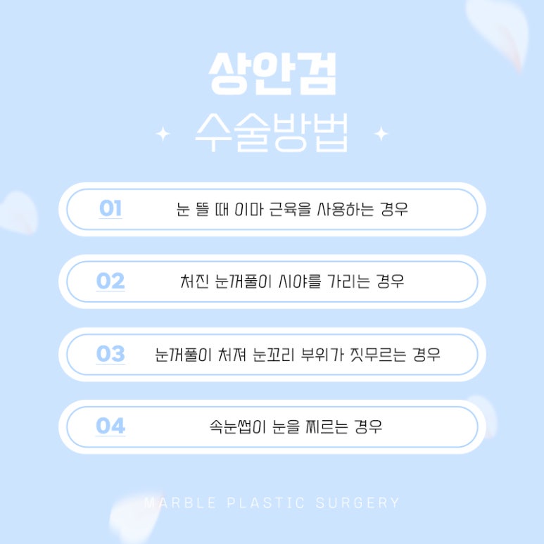 중년눈성형 더 예리하고 젊게 관련 이미지 11
